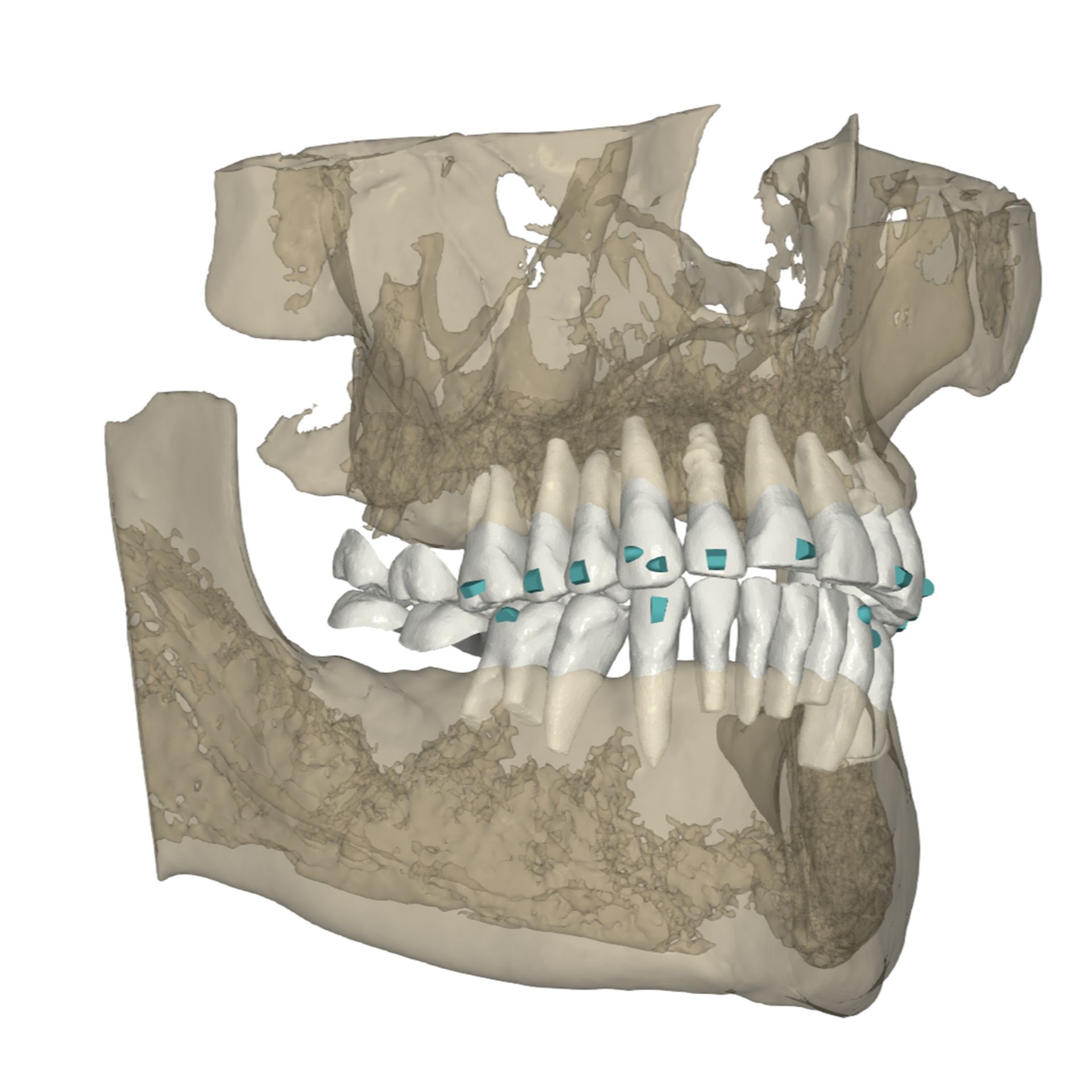 Case evaluation